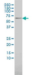 MAP3K7IP1 Antibody in Western Blot (WB)