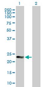 MAD2L2 Antibody in Western Blot (WB)