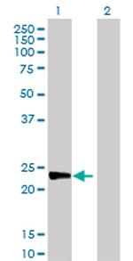 MAD2L2 Antibody in Western Blot (WB)