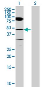 TADA3L Antibody in Western Blot (WB)