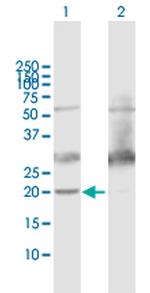 ATP5H Antibody in Western Blot (WB)