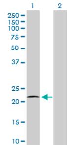 ATP5H Antibody in Western Blot (WB)