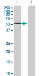 STK25 Antibody in Western Blot (WB)