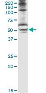 STK25 Antibody in Immunoprecipitation (IP)