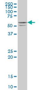 STK25 Antibody in Western Blot (WB)