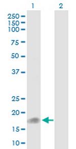 UBD Antibody in Western Blot (WB)