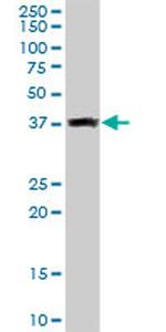 GLRX3 Antibody in Western Blot (WB)