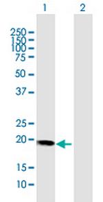 HBXIP Antibody in Western Blot (WB)