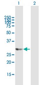 HTATIP2 Antibody in Western Blot (WB)