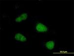 SIVA Antibody in Immunocytochemistry (ICC/IF)