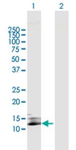 SIVA Antibody in Western Blot (WB)