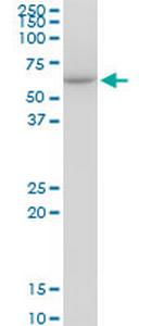 CCT7 Antibody in Western Blot (WB)