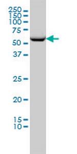 CCT2 Antibody in Western Blot (WB)