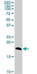 NPC2 Antibody in Western Blot (WB)