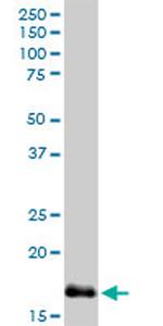 NPC2 Antibody in Western Blot (WB)