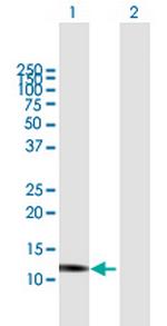 GNLY Antibody in Western Blot (WB)