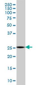 MTHFS Antibody in Western Blot (WB)