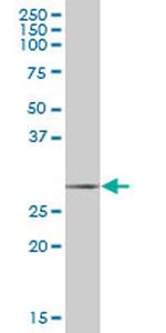 SCGN Antibody in Western Blot (WB)