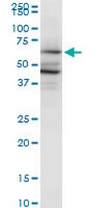 PAIP1 Antibody in Western Blot (WB)