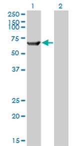 TRIM16 Antibody in Western Blot (WB)