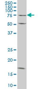 TRIM16 Antibody in Western Blot (WB)