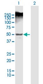 LEFTY1 Antibody in Western Blot (WB)