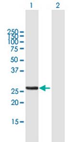 MTX2 Antibody in Western Blot (WB)