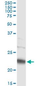 PMVK Antibody in Immunoprecipitation (IP)