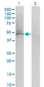 KLF1 Antibody in Western Blot (WB)