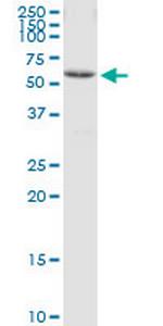 CCT8 Antibody in Western Blot (WB)