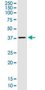 LASS1 Antibody in Western Blot (WB)