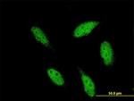 TBR1 Antibody in Immunocytochemistry (ICC/IF)