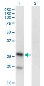 KLRA1 Antibody in Western Blot (WB)