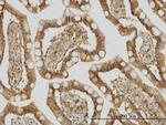 TRAF3IP2 Antibody in Immunohistochemistry (Paraffin) (IHC (P))