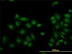 KDM5B Antibody in Immunocytochemistry (ICC/IF)