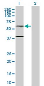 AHCYL1 Antibody in Western Blot (WB)