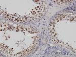 FUSIP1 Antibody in Immunohistochemistry (Paraffin) (IHC (P))