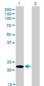 FUSIP1 Antibody in Western Blot (WB)