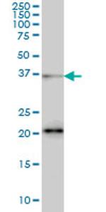 FUSIP1 Antibody in Western Blot (WB)