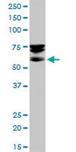 SEPT9 Antibody in Western Blot (WB)