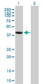 SDCCAG8 Antibody in Western Blot (WB)