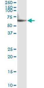 CYP46A1 Antibody in Immunoprecipitation (IP)