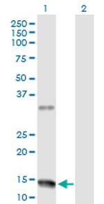 NMU Antibody in Western Blot (WB)