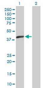 ACTL7B Antibody in Western Blot (WB)