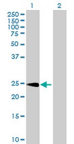 CPSF4 Antibody in Western Blot (WB)