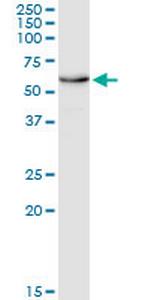 EDAR Antibody in Western Blot (WB)