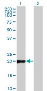 COPS8 Antibody in Western Blot (WB)