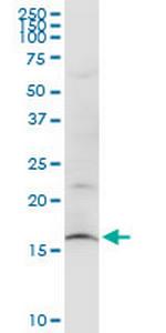 SUB1 Antibody in Western Blot (WB)