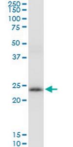 PRDX3 Antibody in Western Blot (WB)
