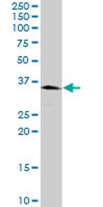 PRDX3 Antibody in Western Blot (WB)